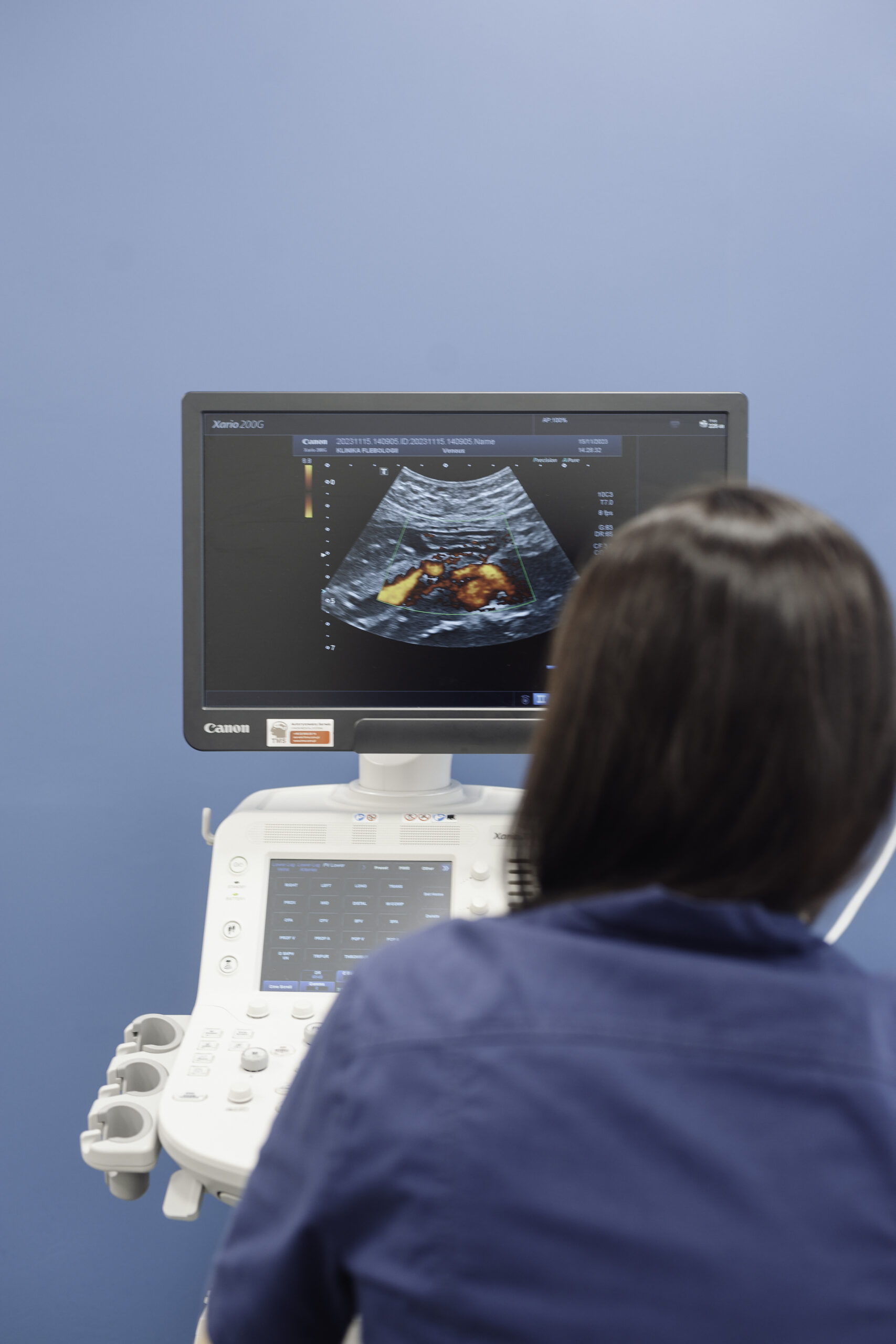 Doppler ultrasound - diagnosis of venous malformations and assessment of blood flow. Specialised ultrasound examinations in the Phlebology Clinic.
