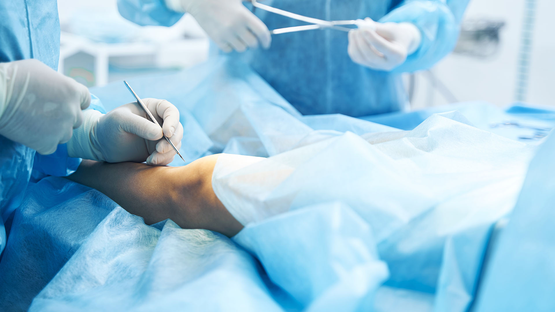 Chirurgia żył. Klinika Flebologii